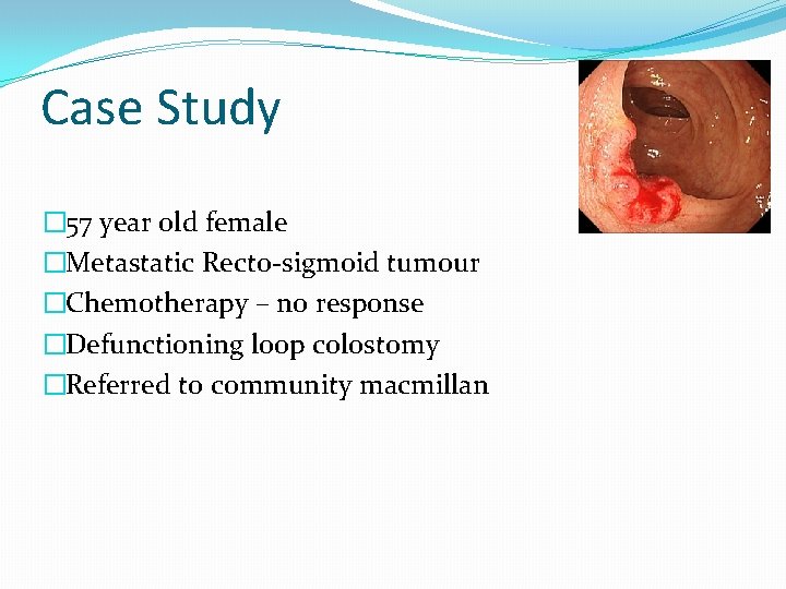 Case Study � 57 year old female �Metastatic Recto-sigmoid tumour �Chemotherapy – no response