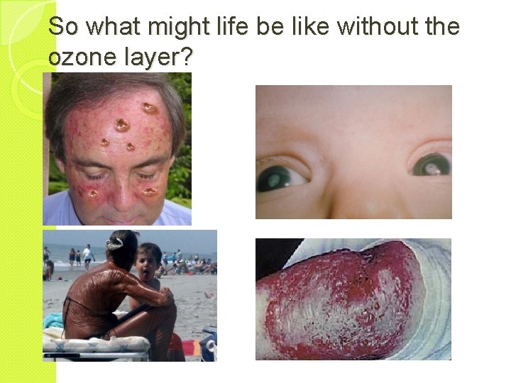 So what might life be like without the ozone layer? 