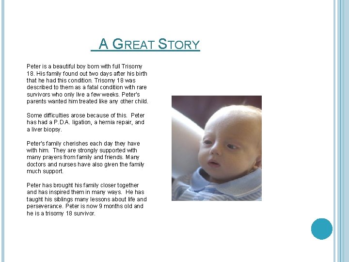 A GREAT STORY Peter is a beautiful boy born with full Trisomy 18. His