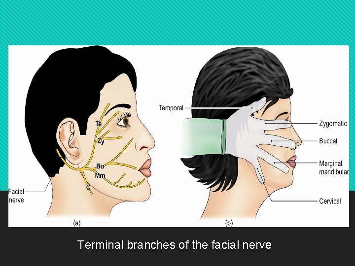 Terminal branches of the facial nerve 