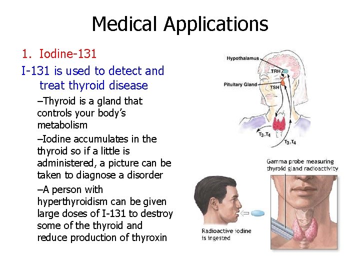Medical Applications 1. Iodine-131 I-131 is used to detect and treat thyroid disease –Thyroid