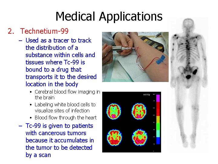 Medical Applications 2. Technetium-99 – Used as a tracer to track the distribution of