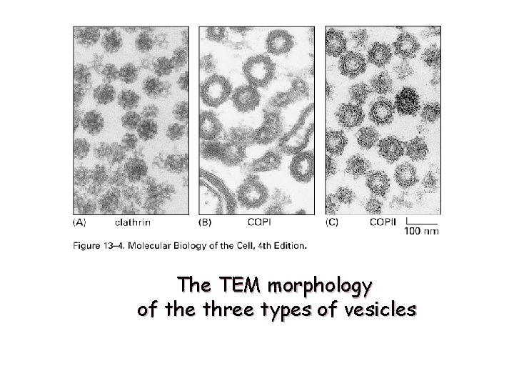 The TEM morphology of the three types of vesicles 