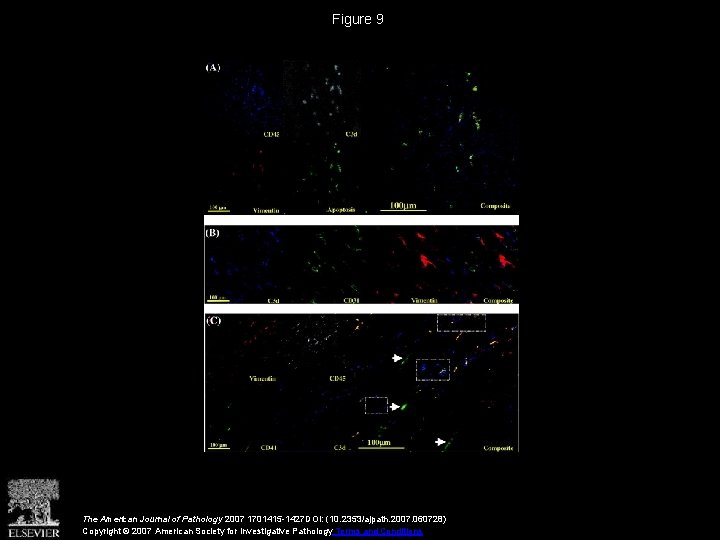 Figure 9 The American Journal of Pathology 2007 1701415 -1427 DOI: (10. 2353/ajpath. 2007.