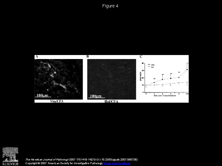 Figure 4 The American Journal of Pathology 2007 1701415 -1427 DOI: (10. 2353/ajpath. 2007.