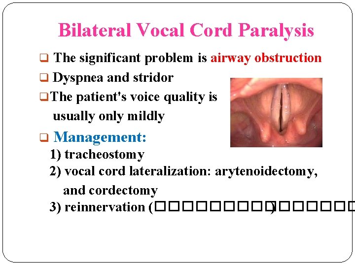 Bilateral Vocal Cord Paralysis q The significant problem is airway obstruction q Dyspnea and