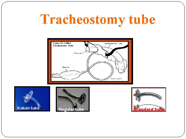 Tracheostomy tube Koken tube Regular tube Low Presser cuff Standard tube 