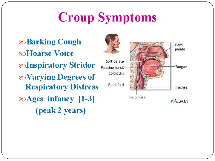 Croup Symptoms Barking Cough Hoarse Voice Inspiratory Stridor Varying Degrees of Respiratory Distress Ages