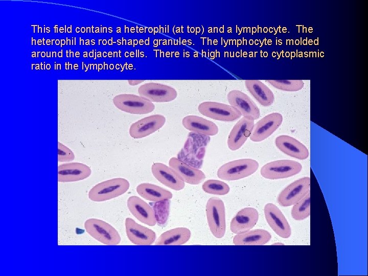 This field contains a heterophil (at top) and a lymphocyte. The heterophil has rod-shaped