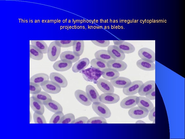 This is an example of a lymphocyte that has irregular cytoplasmic projections, known as