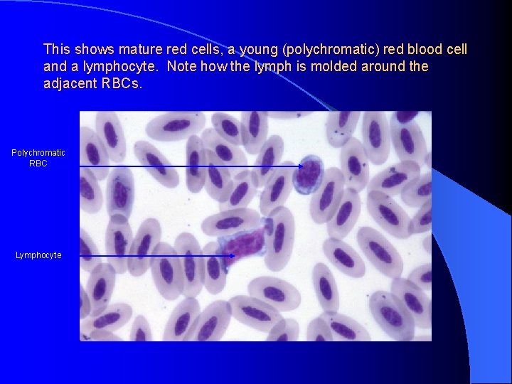 This shows mature red cells, a young (polychromatic) red blood cell and a lymphocyte.