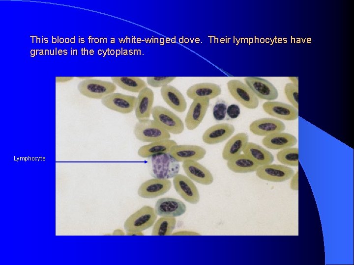 This blood is from a white-winged dove. Their lymphocytes have granules in the cytoplasm.