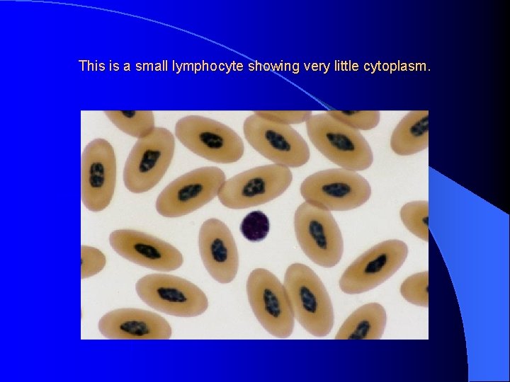 This is a small lymphocyte showing very little cytoplasm. 