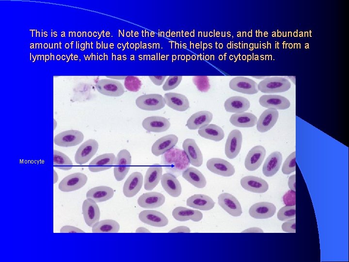 This is a monocyte. Note the indented nucleus, and the abundant amount of light