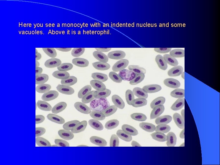 Here you see a monocyte with an indented nucleus and some vacuoles. Above it