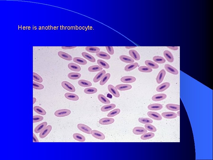 Here is another thrombocyte. 