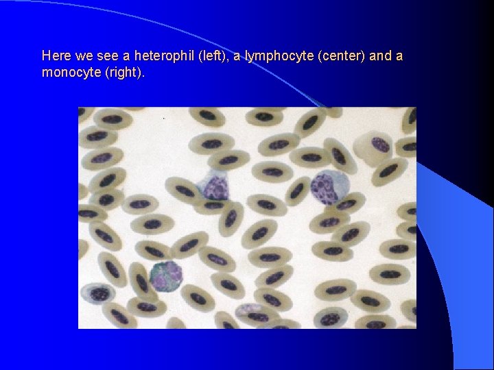 Here we see a heterophil (left), a lymphocyte (center) and a monocyte (right). 