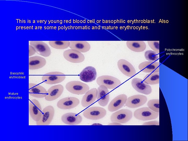 This is a very young red blood cell or basophilic erythroblast. Also present are
