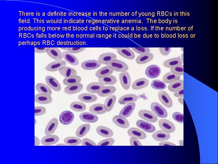 There is a definite increase in the number of young RBCs in this field.