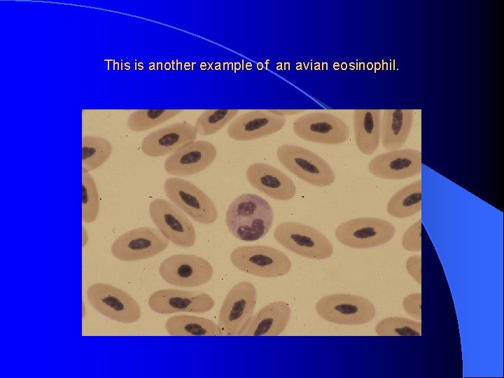 This is another example of an avian eosinophil. 