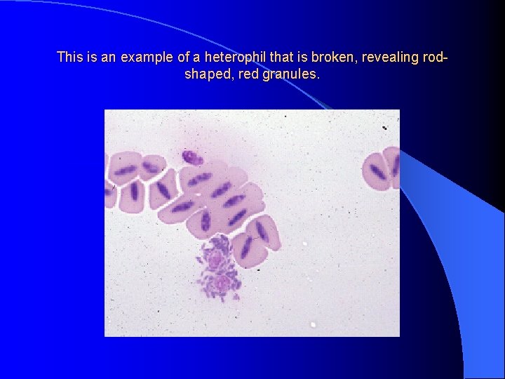 This is an example of a heterophil that is broken, revealing rodshaped, red granules.