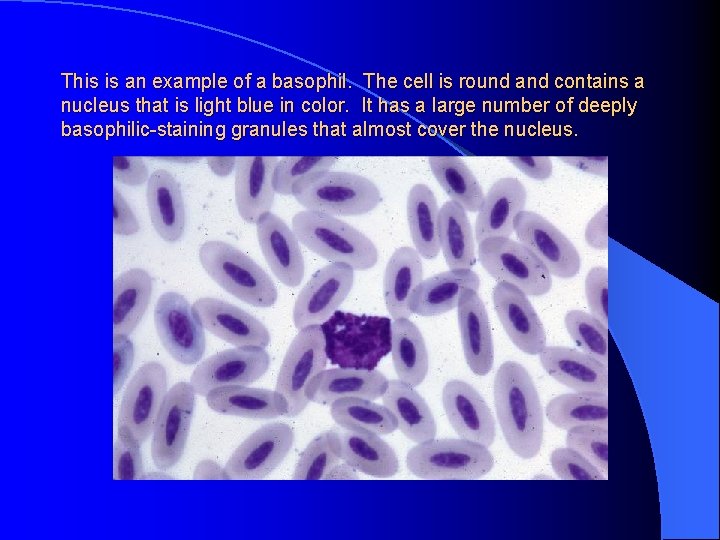 This is an example of a basophil. The cell is round and contains a