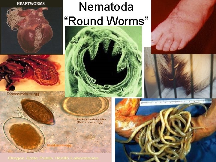 Nematoda “Round Worms” 