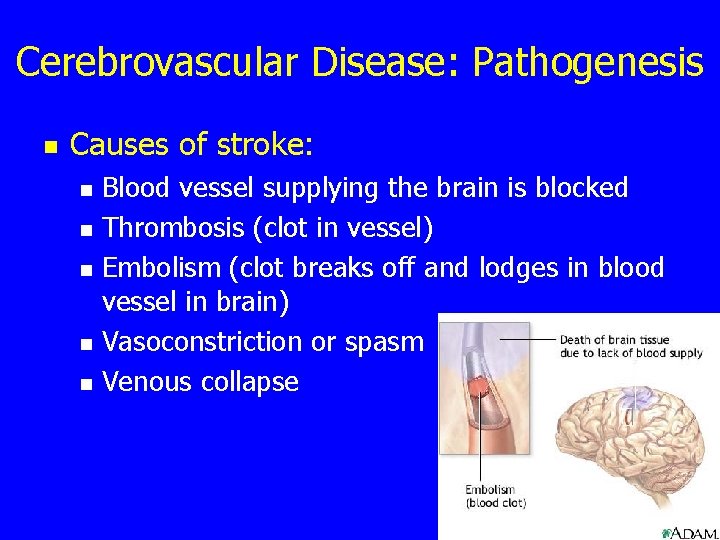 Cerebrovascular Disease: Pathogenesis n Causes of stroke: n n n Blood vessel supplying the