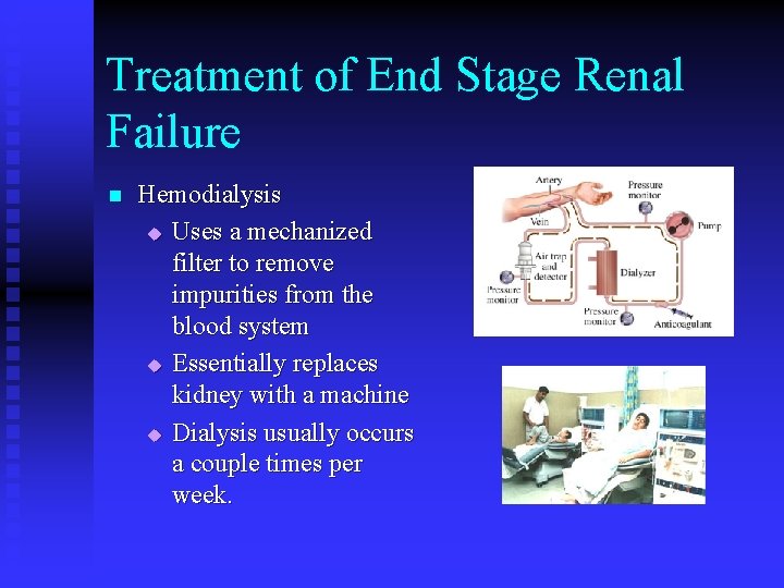 Treatment of End Stage Renal Failure n Hemodialysis u Uses a mechanized filter to