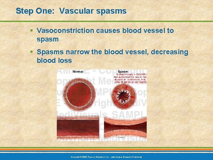 Step One: Vascular spasms § Vasoconstriction causes blood vessel to spasm § Spasms narrow