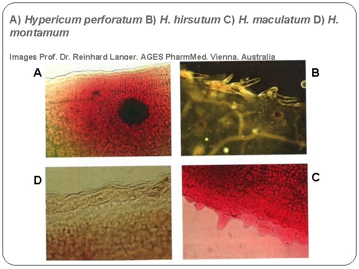 A) Hypericum perforatum B) H. hirsutum C) H. maculatum D) H. montamum Images Prof.