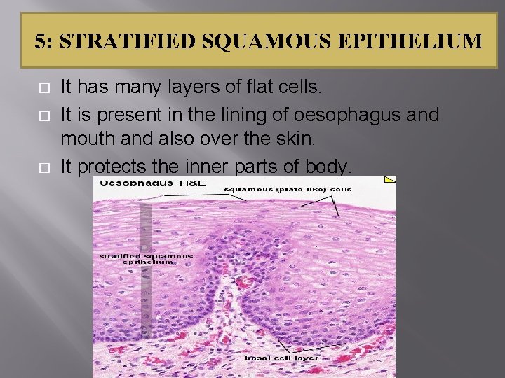 5: STRATIFIED SQUAMOUS EPITHELIUM � � � It has many layers of flat cells.