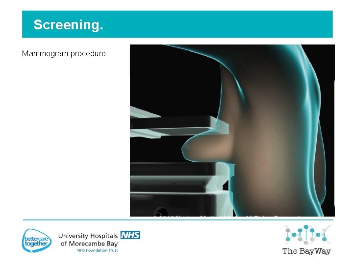 Screening. Mammogram procedure Mammogram Images. 