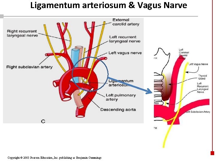 Ligamentum arteriosum & Vagus Narve Copyright © 2003 Pearson Education, Inc. publishing as Benjamin