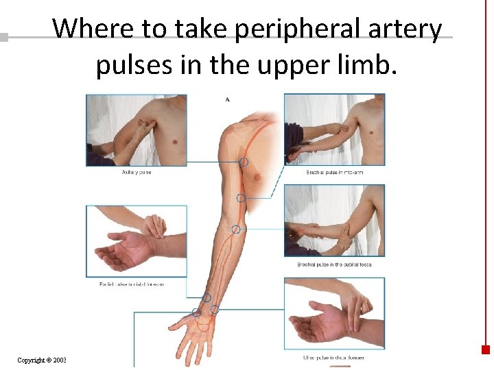 Where to take peripheral artery pulses in the upper limb. Copyright © 2003 Pearson