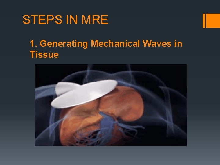 STEPS IN MRE 1. Generating Mechanical Waves in Tissue 