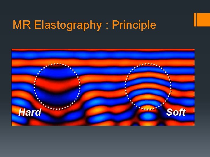 MR Elastography : Principle 