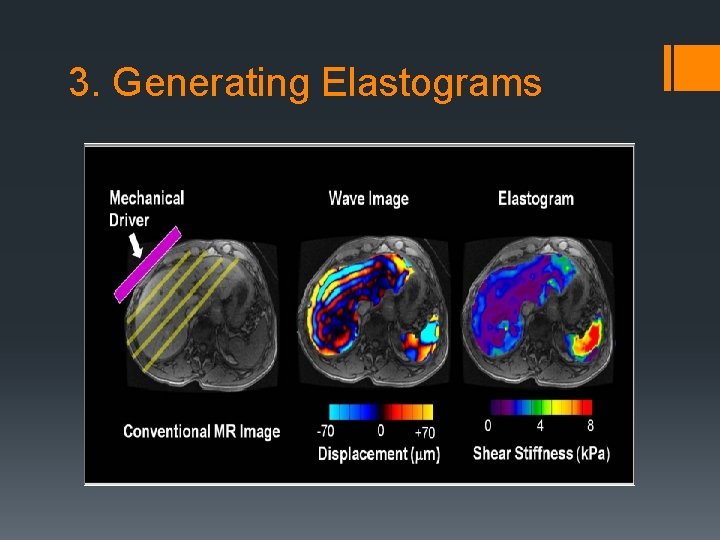 3. Generating Elastograms 