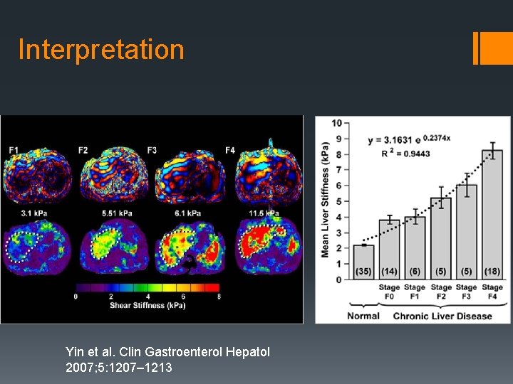 Interpretation Yin et al. Clin Gastroenterol Hepatol 2007; 5: 1207– 1213 