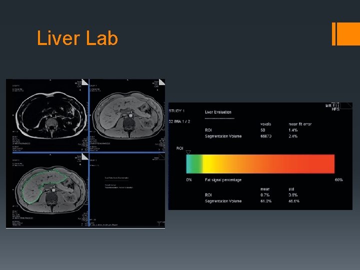 Liver Lab 
