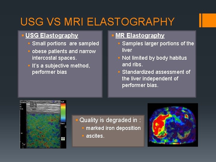 USG VS MRI ELASTOGRAPHY § USG Elastography § MR Elastography § Small portions are