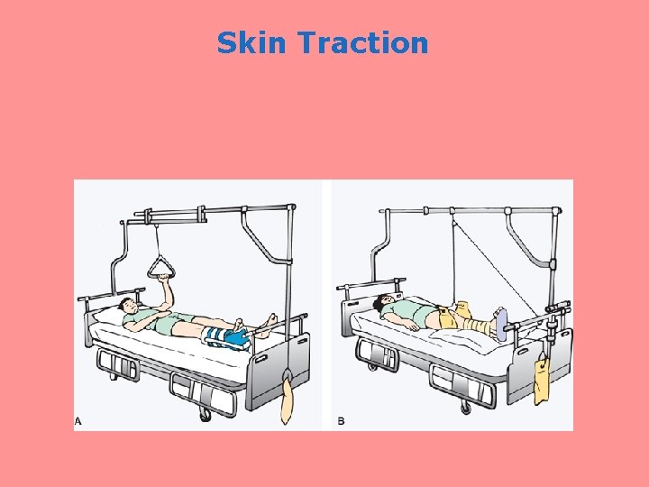 Skin Traction 