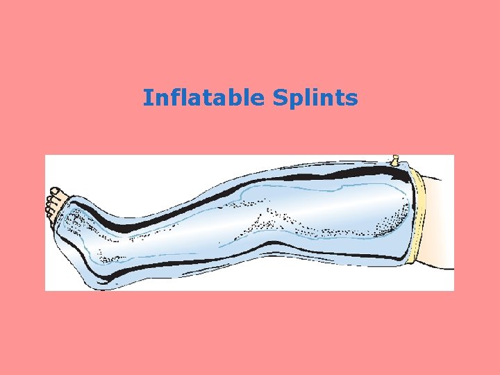 Inflatable Splints 