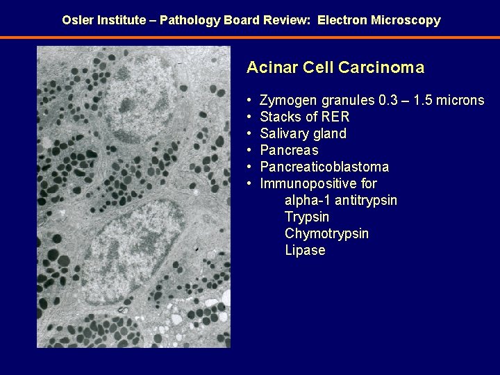 Osler Institute – Pathology Board Review: Electron Microscopy Acinar Cell Carcinoma • • •