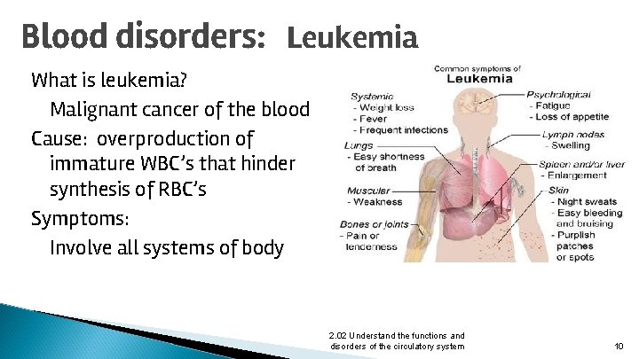Blood disorders: Leukemia What is leukemia? Malignant cancer of the blood Cause: overproduction of