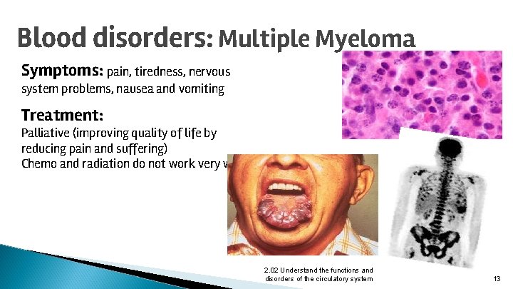 Blood disorders: Multiple Myeloma Symptoms: pain, tiredness, nervous system problems, nausea and vomiting Treatment: