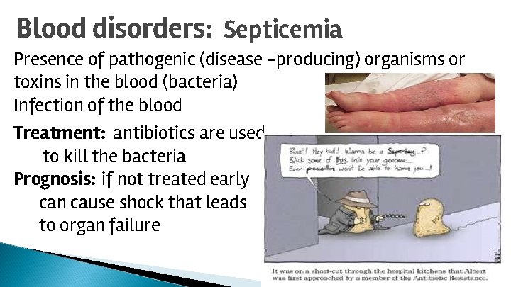 Blood disorders: Septicemia Presence of pathogenic (disease -producing) organisms or toxins in the blood
