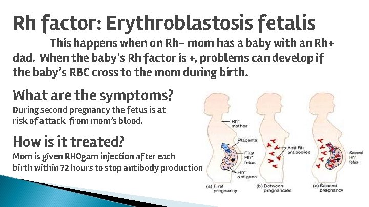 Rh factor: Erythroblastosis fetalis This happens when on Rh- mom has a baby with