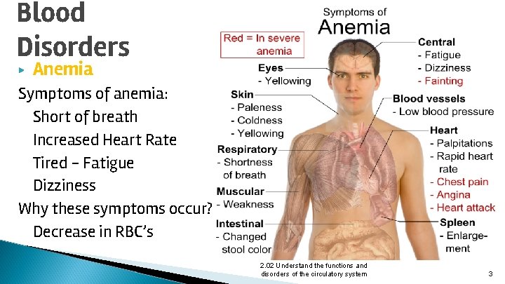 Blood Disorders ▶ Anemia Symptoms of anemia: Short of breath Increased Heart Rate Tired