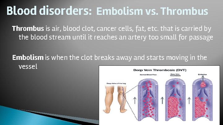 Blood disorders: Embolism vs. Thrombus is air, blood clot, cancer cells, fat, etc. that